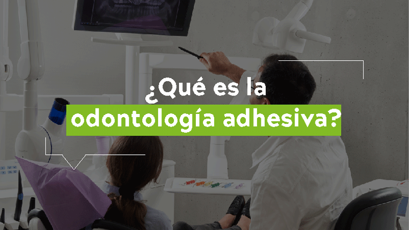 odontologia-adhesiva